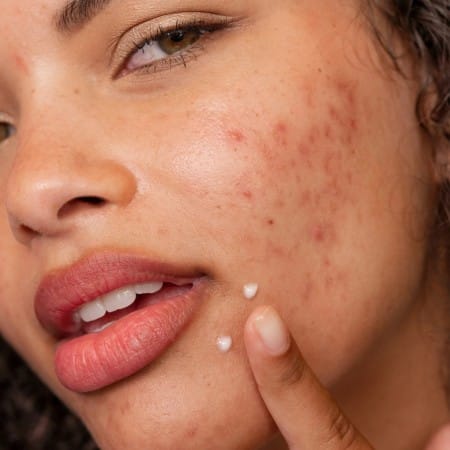 Гель-крем для лікування плям після висипань Clear Start Post Breakout Fix Dermalogica 15 мл - Зображення 3